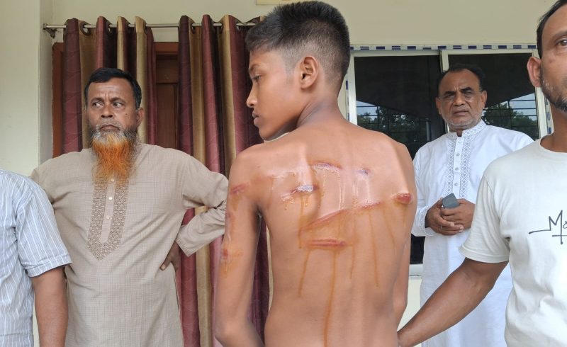 রাজবাড়ীর পাংশায় শিক্ষকের বেত্রাঘাতে হাসপাতালে ছাত্র, অবরুদ্ধ শিক্ষক